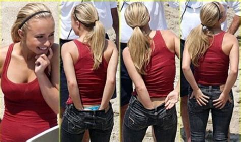 Anal Itching Causes And Treatment 2