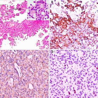 Photomicrographs Showing The Histological And Immunohistochemical