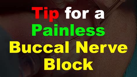 Tip For Painless Buccal Nerve Block Youtube