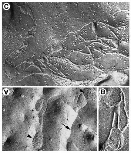 Freeze Fracture Transmission Electron Micrographs Of Urotsa Cells