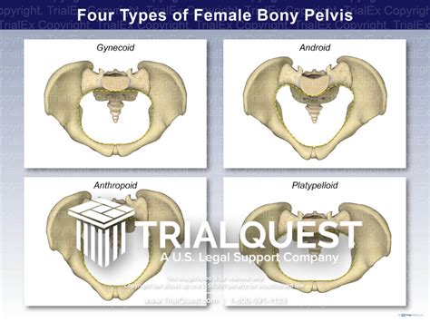 Four Types Of Female Bony Pelvis Trialexhibits Inc