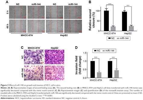 Mir 144 Suppresses Cell Proliferation Migration And Invasion In Hepa Ott