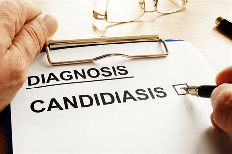 Effective Candidiasis Treatment At Cross Street Clinic Singapore