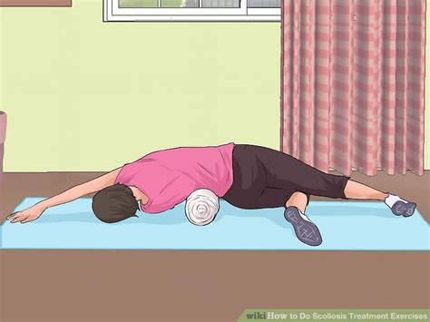 3 Ways To Do Scoliosis Treatment Exercises Wikihow