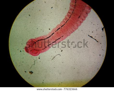 116 Taenia Saginata Stock Photos, Images & Photography | Shutterstock