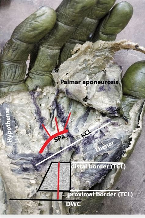 Figure From The Reliability Of Kaplans Cardinal Line As A Potential