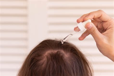 Deciphering Hair Loss Medications A Roadmap To Treatment Solutions