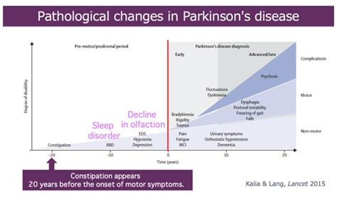 Department Of Research For Parkinsons Disease Juntendo University