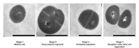 Figure From Staphylococcus Aureus Cell Wall Maintenance The