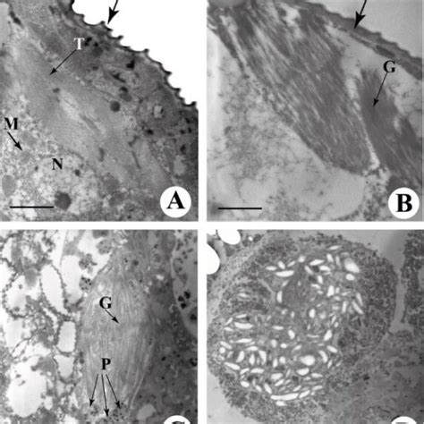 Transmission Electron Microscopy Of TSSM A Ultrathin Section Of A