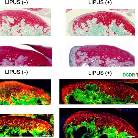 LIPUS Attenuates Cartilage Degeneration In Early Osteoarthritis Like