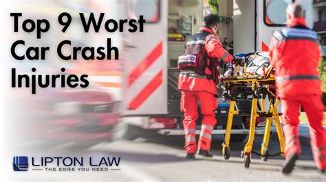 Top 9 Worst Car Crash Injuries Lipton Law Southfield Michigan