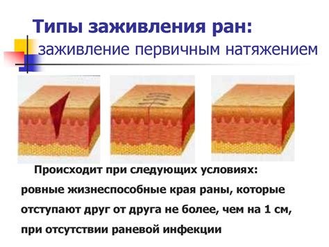 Открытые повреждения (раны) - презентация онлайн