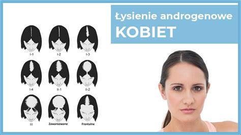 Ysienie Androgenowe Kobiet Youtube