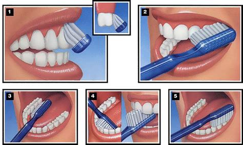 Tehnika Pranja Zuba Stomatolo Ka Poliklinika Oral B Uki