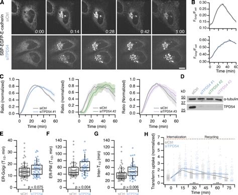 Tpd54 Depleted Cells Have Defective Anterograde Membrane Traffic And Download Scientific