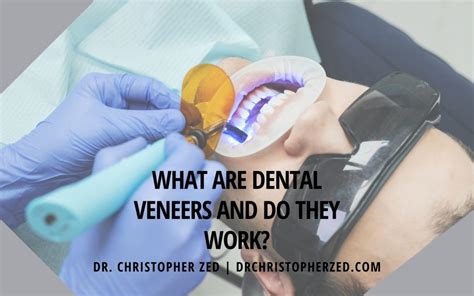 What Are Dental Veneers And Do They Work Dr Christopher Zed