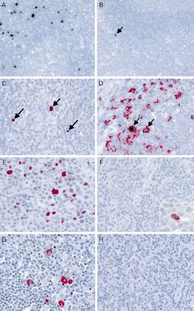 Ab In Situ Hybridisation With 35 S Labelled Small Epstein Barr Virus Download Scientific