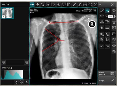 X ray process viewing software medical systems upgrade precise diagnose