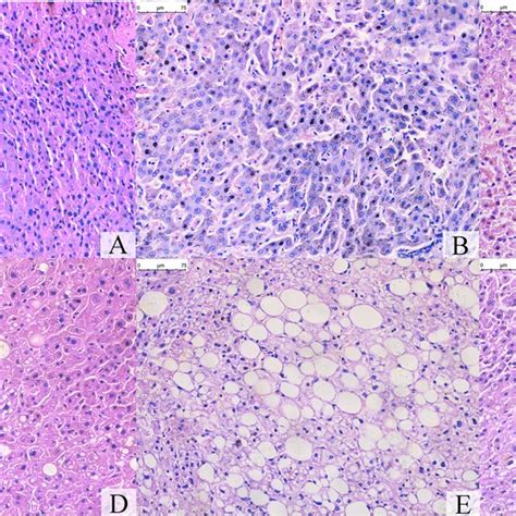 Histopathological Examination Of Liver Tissue A−c Normal Liver Download Scientific Diagram