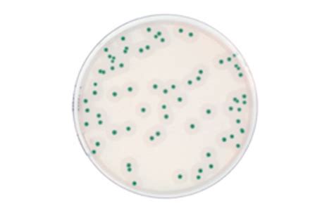 Al Agar Listeria According To Ottaviani And Agosti Medium Agar Food