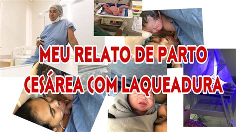 MEU RELATO DE PARTO CESÁREA LAQUEADURA cesarea parto