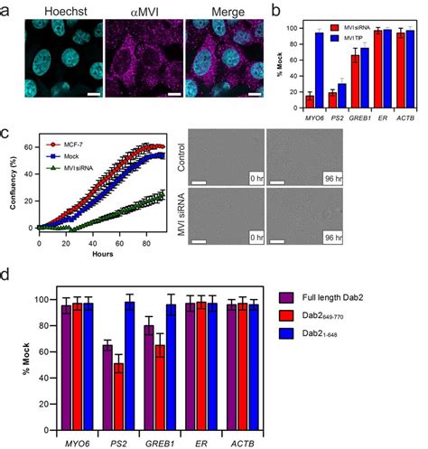 Inhibition Of Myosin VI In Estrogen Linked Gene Expression A