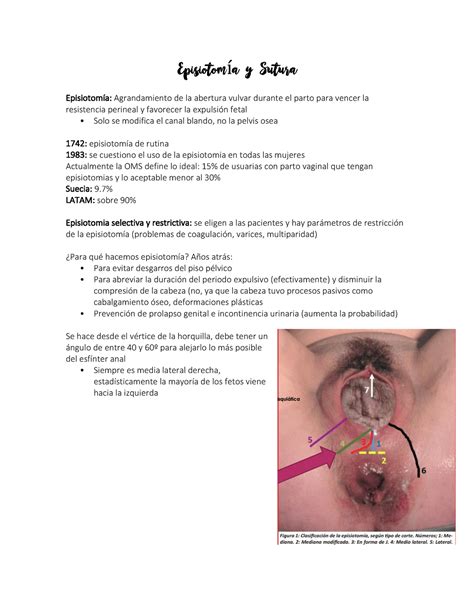 C Mo Se Ve Una Episiotom A Abierta Mibbmemima