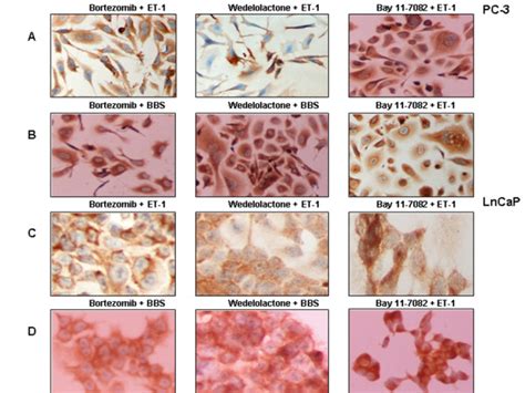 UPS/NFκB pathway inhibitors prevent NP-induced nuclear translocation of ... 