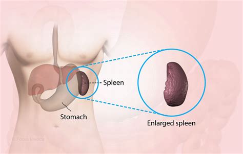 Health Condition : Symptoms, Causes, Treatment and More