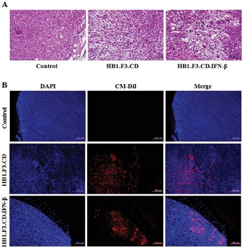 Figure 6 From Pancreatic Tumor Mass In A Xenograft Mouse Model Is