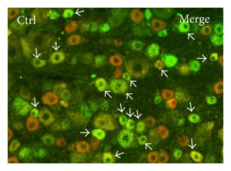 Double Labeling Immunofluorescence For TRPV1 CGRP Ac And Df And