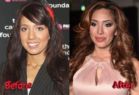 Edozie Emmanuel Hill Blog Farrah Abraham Boob Job Teen Mom Star Gets