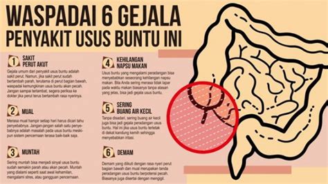 Bisakah Mengobati Usus Buntu Tanpa Operasi Tribunjogja