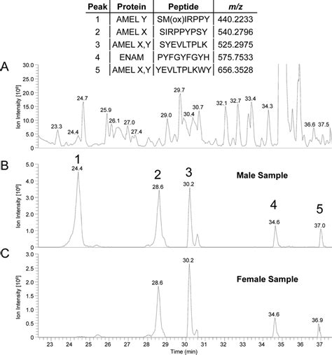 A Representative Base Peak Chromatogram 300 1600 Mz From A Male Download Scientific