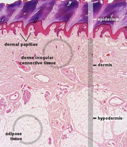 Dermatology Flashcards Quizlet