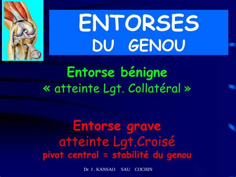 PDF ENTORSES DU GENOU Medesim Fr DOKUMEN TIPS