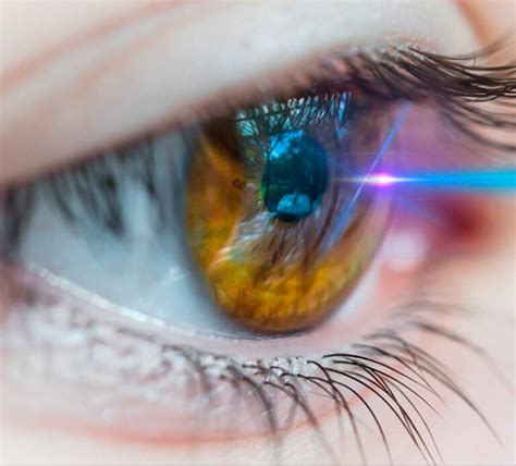 Cirug A Refractiva Retina Luminous