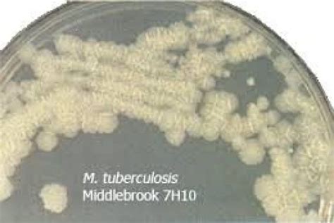 Middlebrook H Agar Nazar T P Ltd Ti