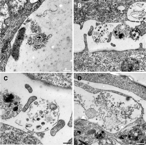 Transmission Electron Micrographs Of Endothelial Compartments And