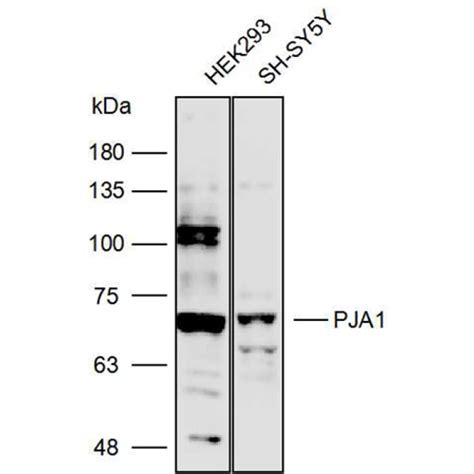 Solarbio K111759P Anti PJA1 Polyclonal Antibody 试剂仪器耗材