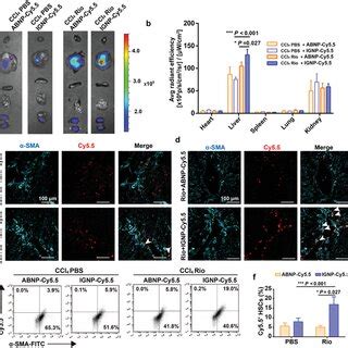 In Vivo Distribution Of Cy Loaded Nanoparticles In Ccl Induced