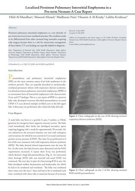 Localized Persistent Pulmonary Interstitial Emphysema in a Pre - OMJ