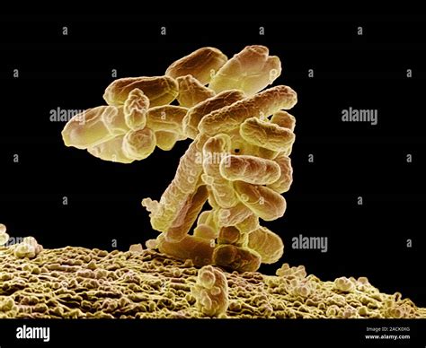 E Coli Bacteria Coloured Scanning Electron Micrograph Sem Escherichia Coli Are Gram