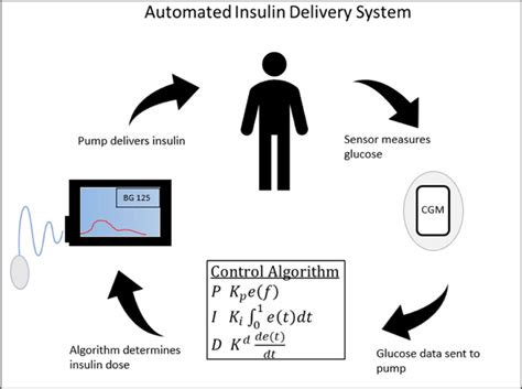 Automated Insulin Delivery System Diagram Depicting Closed Loop