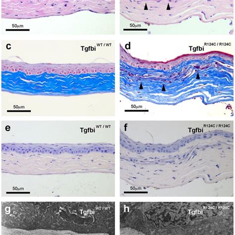 Corneal Opacity In TGFBI R124C Mice Ac The Representative Pictures