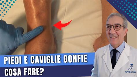 Piedi E Caviglie Gonfie Quali Sono Le Cause Cos La Manovra Della