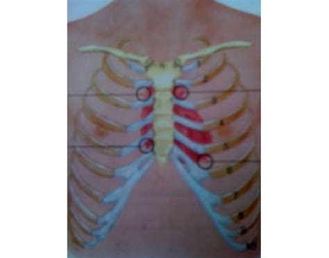 Auscultation Areas Quiz