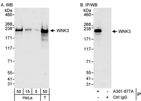 Wnk3 Polyclonal Antibody A301 877a