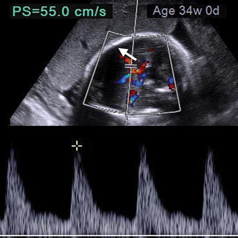 A Radiologists Guide To The Performance And Interpretation Of